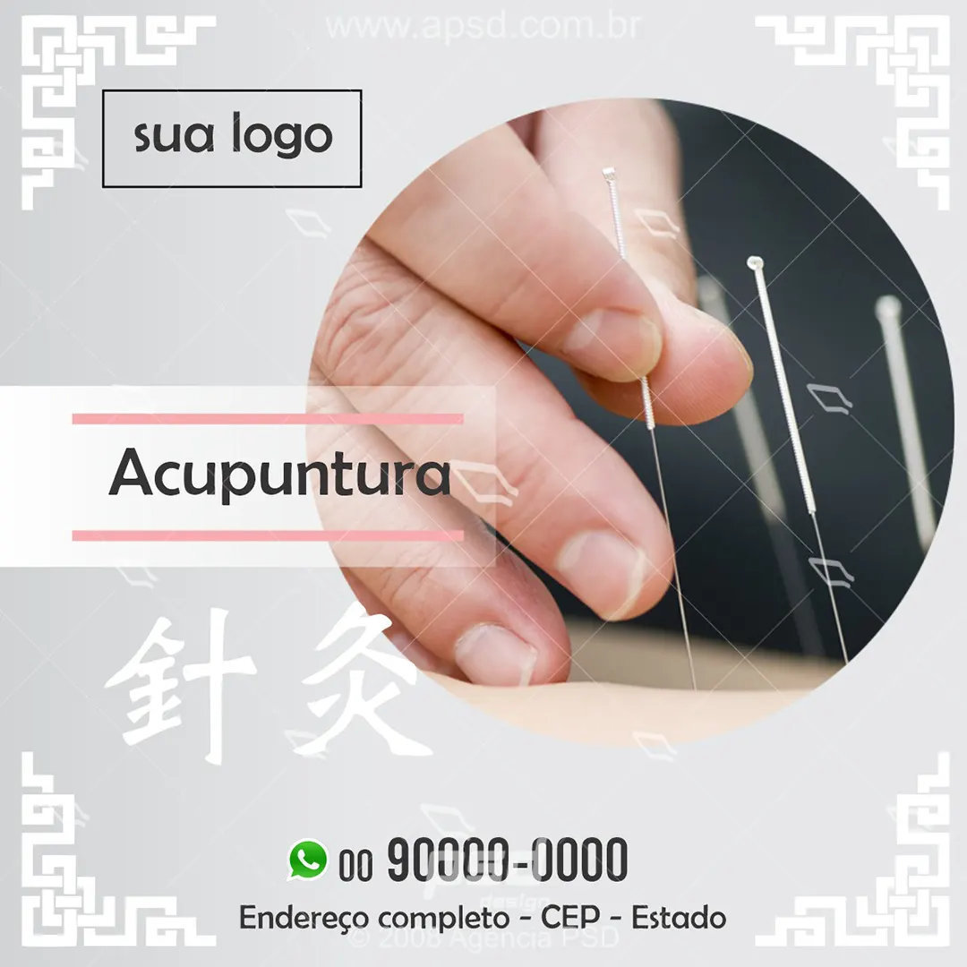 arte acupuntura